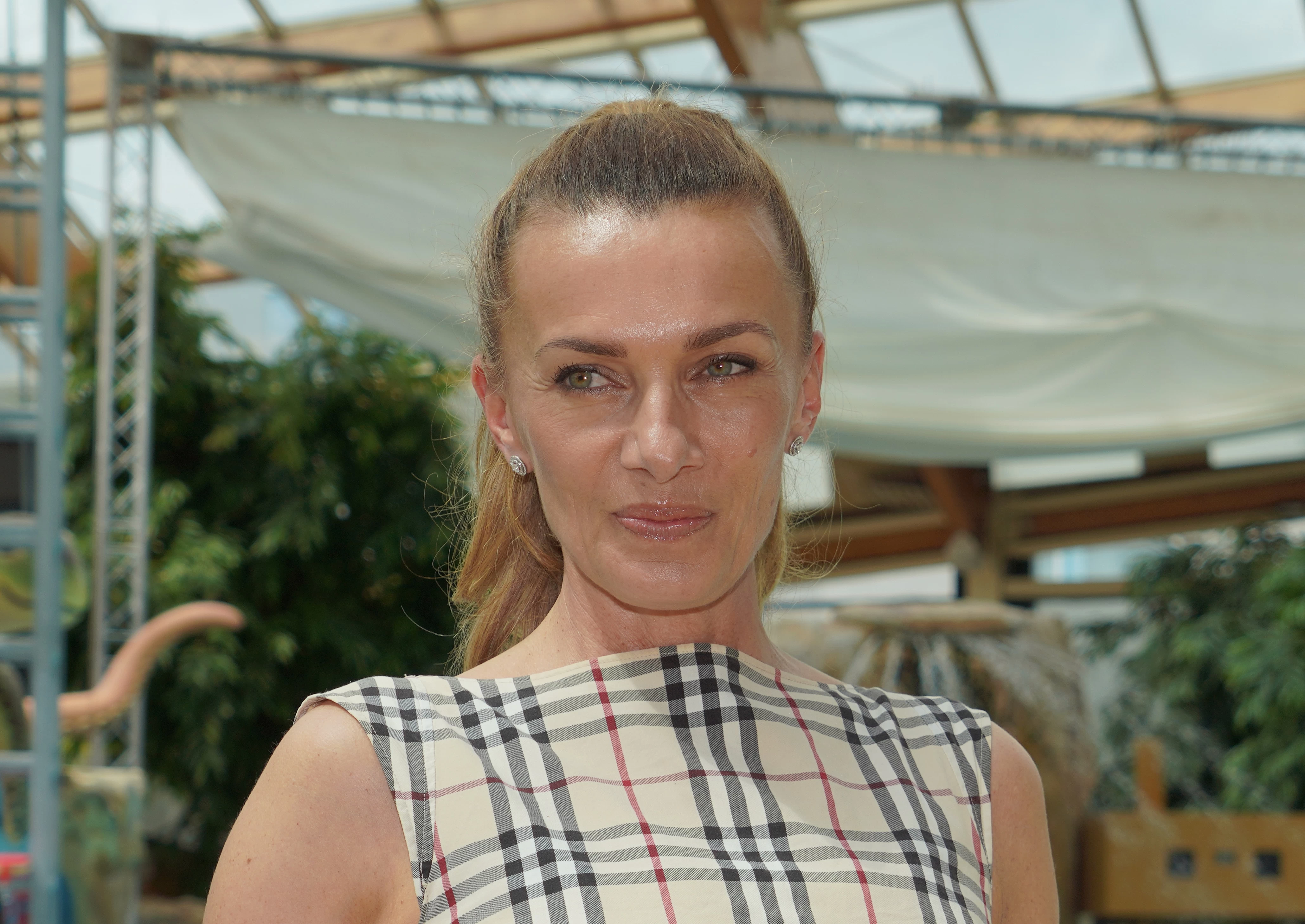 Alice Bendová ukázala tvář po zákroku a strhla pozornost. Lidé ji přirovnávají k sexbombě